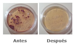 Antes y Después